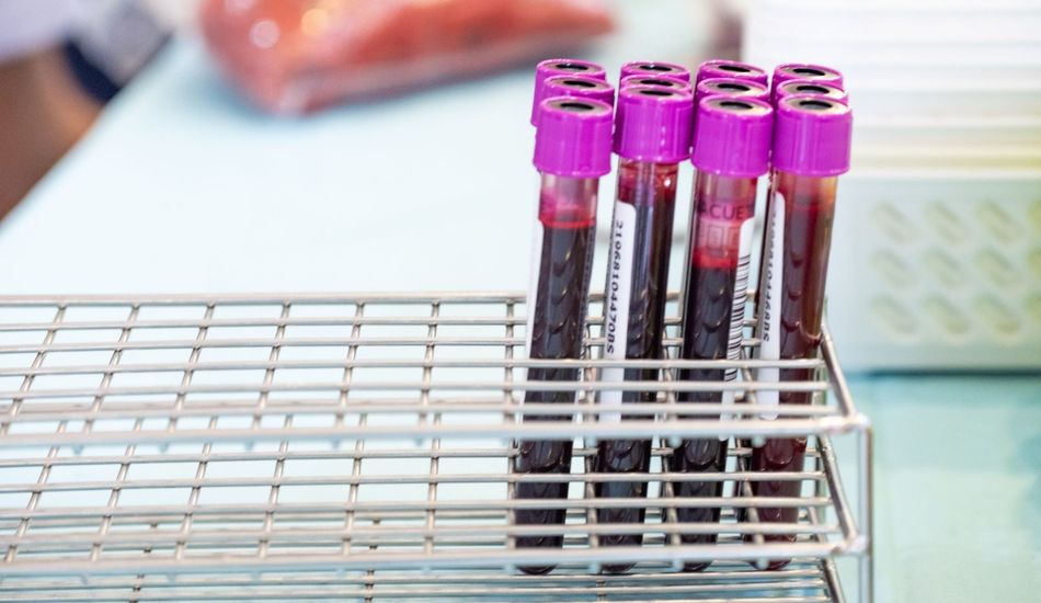 A Simple Blood Test Could Predict Alzheimer's Onset